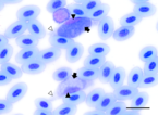 Leucocytozoon toddi aus Echsenhabicht (Accipiter francesiae, Accipitridae) beprobt im Maromizaha Regenwald, Madagaskar. Makrogametozyt (oben) und Mikrogametozyt (unten) in spindelförmigen Wirtszellen. Schwarze Pfeilspitze: Zellkern der Wirtszelle, weiße Pfeilspitze: Zytoplasma der Wirtszelle, schwarzer Pfeil: Zellkörper des Parasiten. Giemsa gefärbter Blutausstrich. Maßstabsbalken = 10 µm. | Bildquelle: Universität Hohenheim / Sandrine Musa